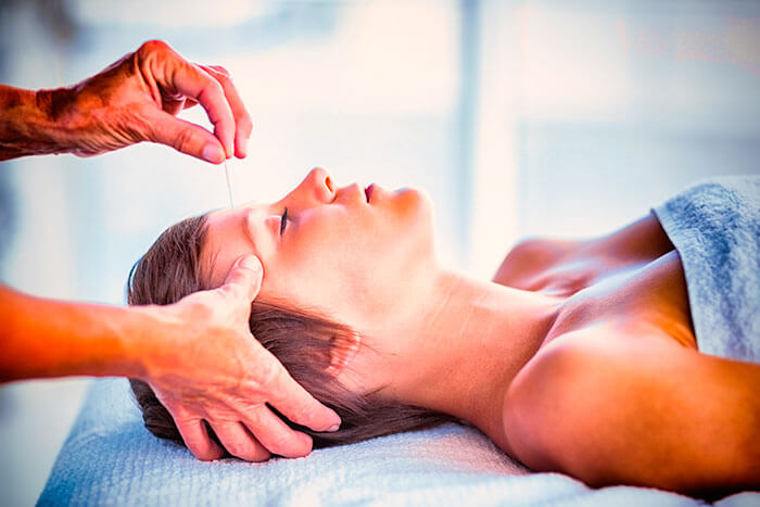 Qué es la acupuntura y qué beneficios tiene